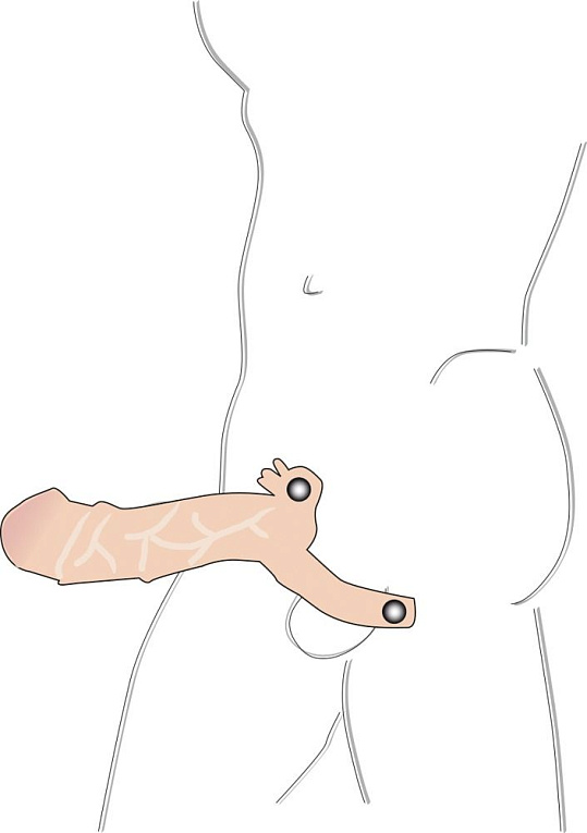 Закрытая телесная насадка на пенис с двумя виброэлементами от Intimcat